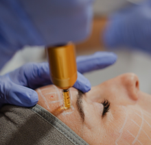 Carregar imagem no visualizador da galeria, Formação: Intradermoterapia Pressurizada – Corpo 7h 25 de Junho 2026