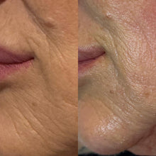 Carregar imagem no visualizador da galeria, Apresentação GRATUITA da BIO-REGENERAÇÃO Dérmica - A Arte de Construir Colagénio com EXOSSOMAS  brevemente