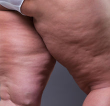 Carregar imagem no visualizador da galeria, Formação Lipedema na area da Estética dias 5 e 6 Outubro 2026