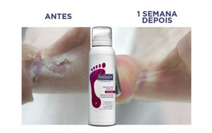 Footlogix - Peeling Skin Pele Descamada 125ml